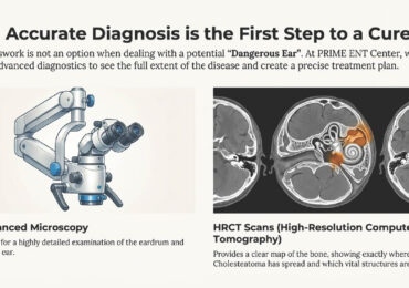 winter nosebleeds diagnosis and treatment guide